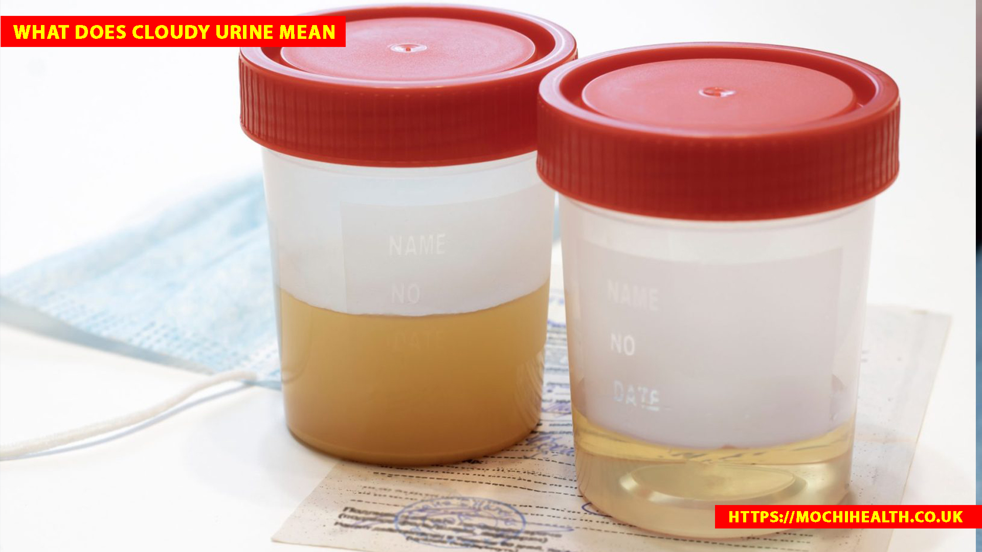 What Does Cloudy Urine Mean