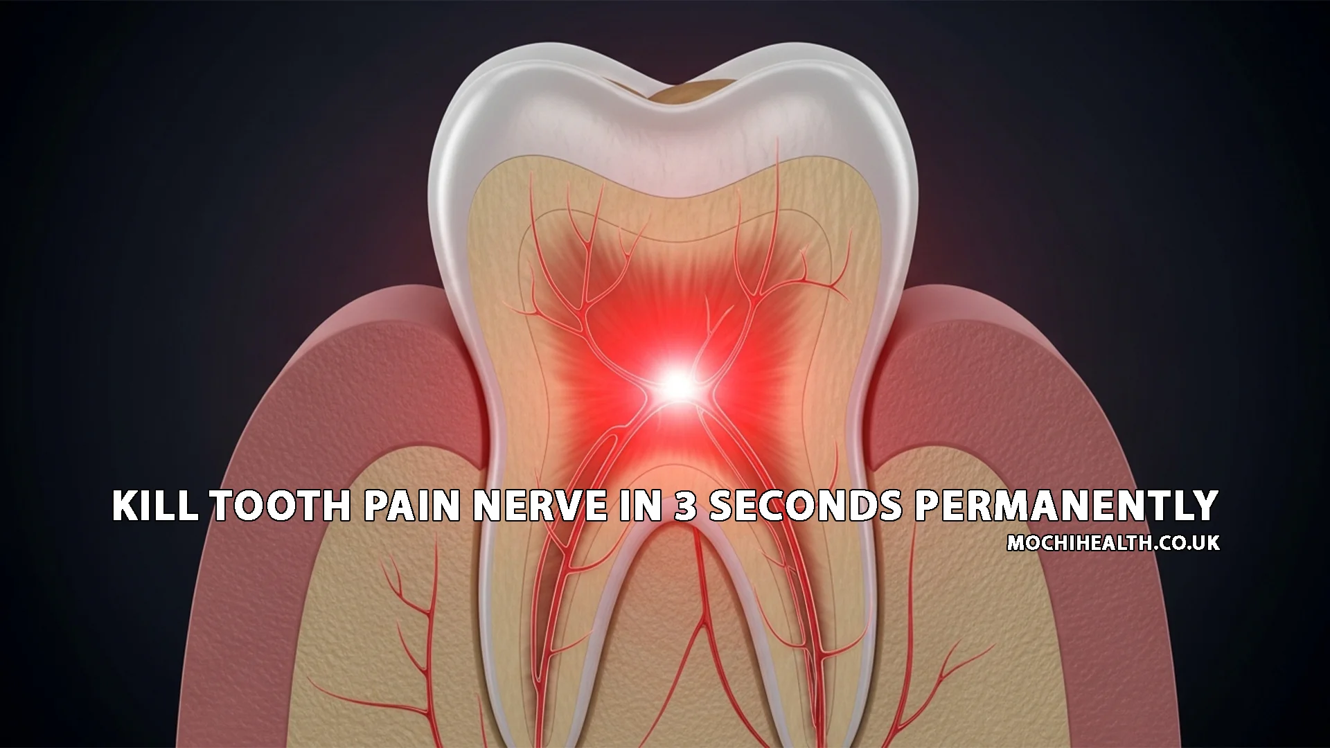 kill tooth pain nerve in 3 seconds permanently